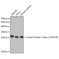 Casein Kinase 2 beta (CSNK2B) Rabbit pAb
