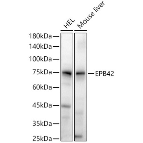 EPB42 Rabbit pAb