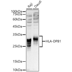 HLA-DPB1 Rabbit pAb