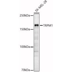TRPM1 Rabbit pAb