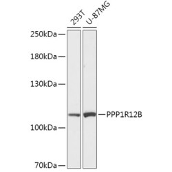 PPP1R12B Rabbit pAb