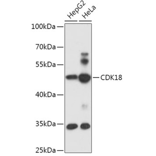 CDK18 Rabbit pAb