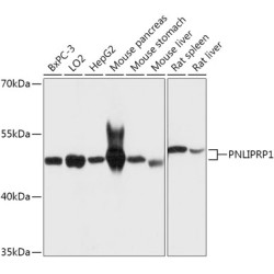 PNLIPRP1 Rabbit pAb