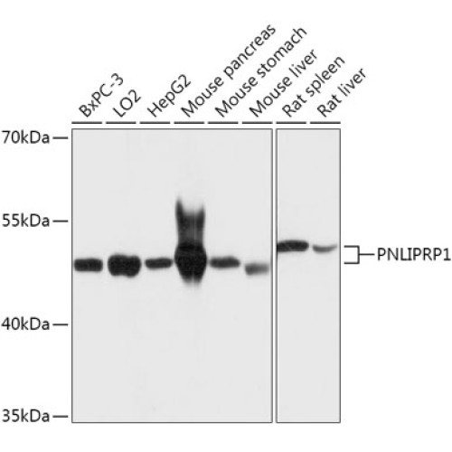 PNLIPRP1 Rabbit pAb