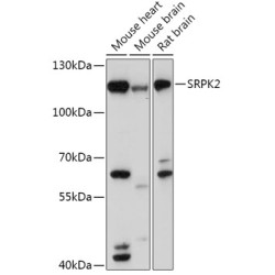 SRPK2 Rabbit pAb