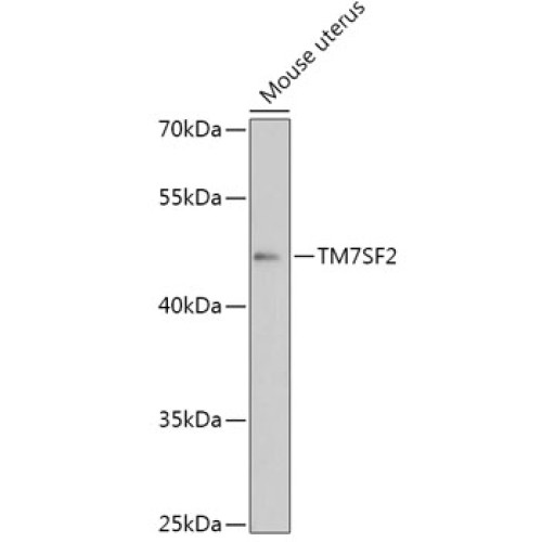 TM7SF2 Rabbit pAb