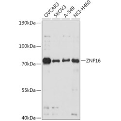 ZNF16 Rabbit pAb