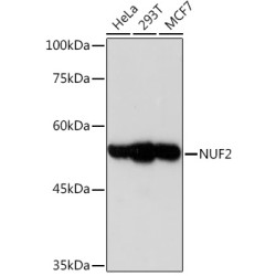 NUF2 Rabbit mAb
