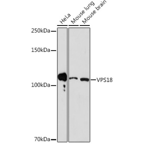 VPS18 Rabbit mAb