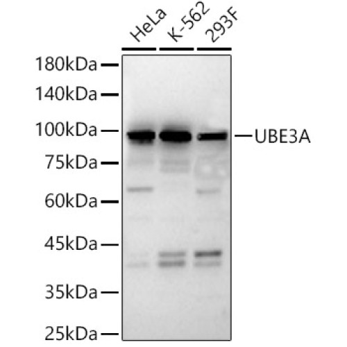 UBE3A Rabbit pAb