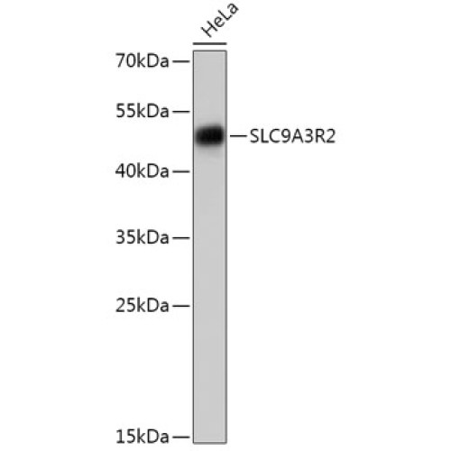 SLC9A3R2 Rabbit pAb