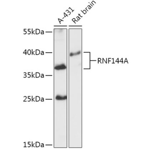 RNF144A Rabbit pAb