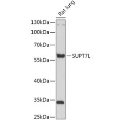 SUPT7L Rabbit pAb
