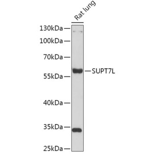 SUPT7L Rabbit pAb