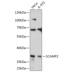 SCAMP2 Rabbit pAb