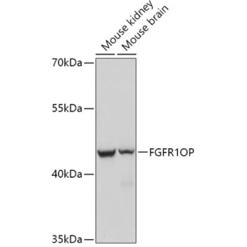 FGFR1OP Rabbit pAb