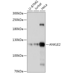 ANKLE2 Rabbit pAb