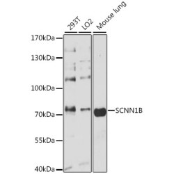 SCNN1B Rabbit pAb