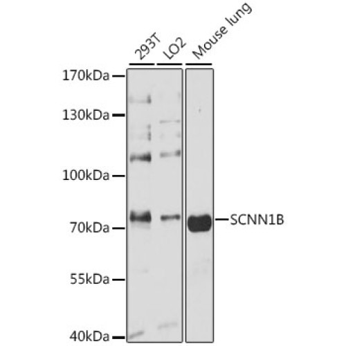 SCNN1B Rabbit pAb