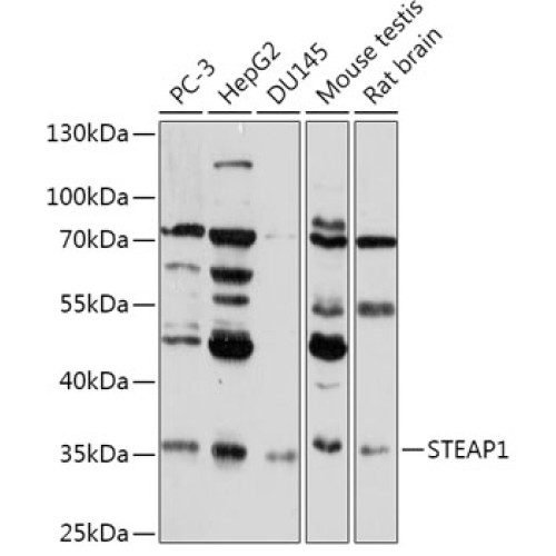 STEAP1 Rabbit pAb