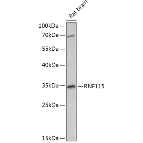 RNF115 Rabbit pAb