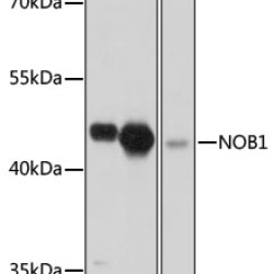 NOB1 Rabbit pAb