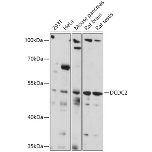 DCDC2 Rabbit pAb