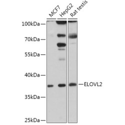 ELOVL2 Rabbit pAb