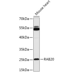 RAB20 Rabbit pAb