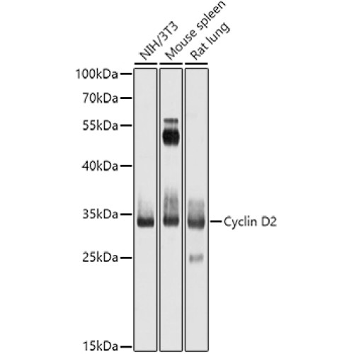 Cyclin D2 Rabbit pAb