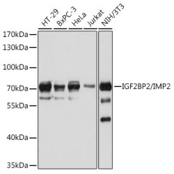 IGF2BP2/IMP2 Rabbit pAb