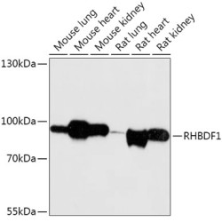RHBDF1 Rabbit pAb