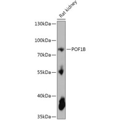 POF1B Rabbit pAb