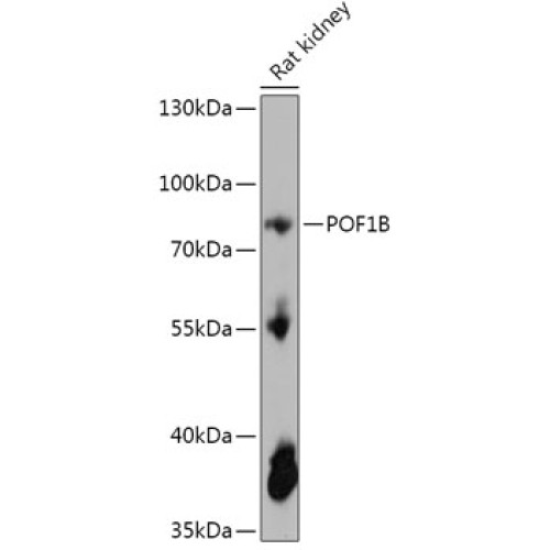 POF1B Rabbit pAb