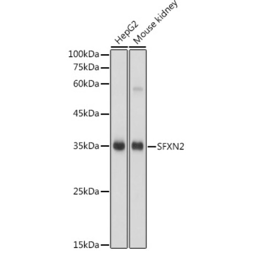 SFXN2 Rabbit pAb