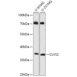 CLVS2 Rabbit pAb