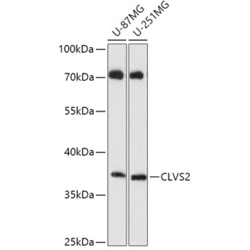 CLVS2 Rabbit pAb