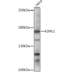 A2ML1 Rabbit pAb