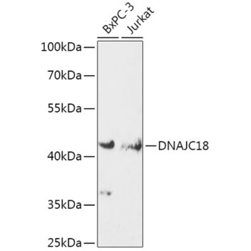 DNAJC18 Rabbit pAb