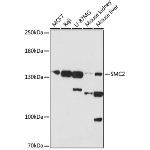 SMC2 Rabbit pAb