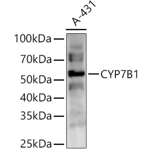 CYP7B1 Rabbit pAb