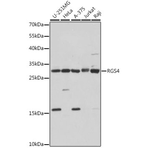 RGS4 Rabbit pAb