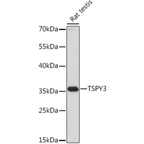 TSPY3 Rabbit pAb
