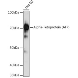 Alpha-Fetoprotein (AFP) Mouse mAb