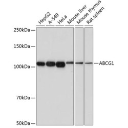 ABCG1 Rabbit mAb