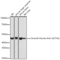 α-Smooth Muscle Actin (ACTA2) Rabbit mAb