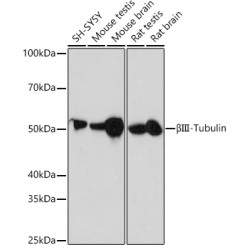[KD Validated] βIII-Tubulin Rabbit mAb