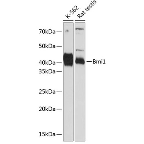 Bmi1 Rabbit mAb
