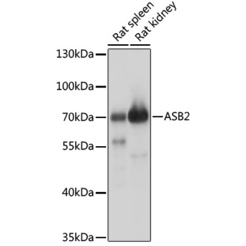 ASB2 Rabbit pAb