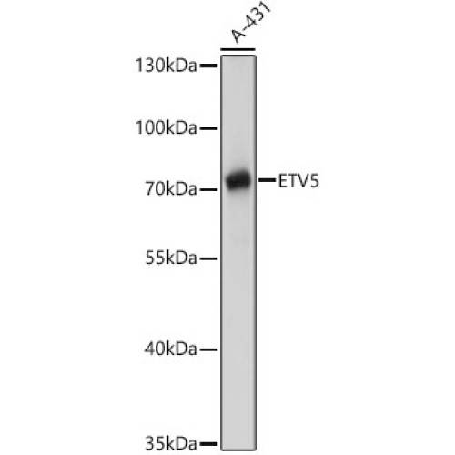 ETV5 Rabbit pAb